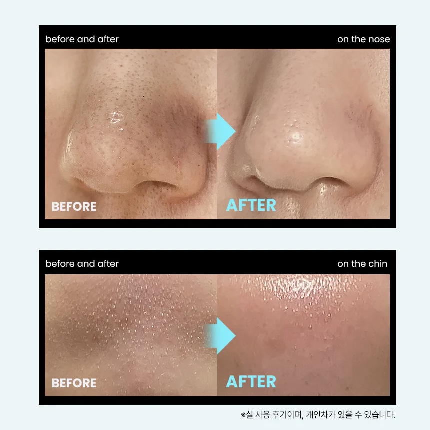 Ilso Super Melting Sebum Softener 150ml + Saving Cotton Pad (40ea) - Figura 3